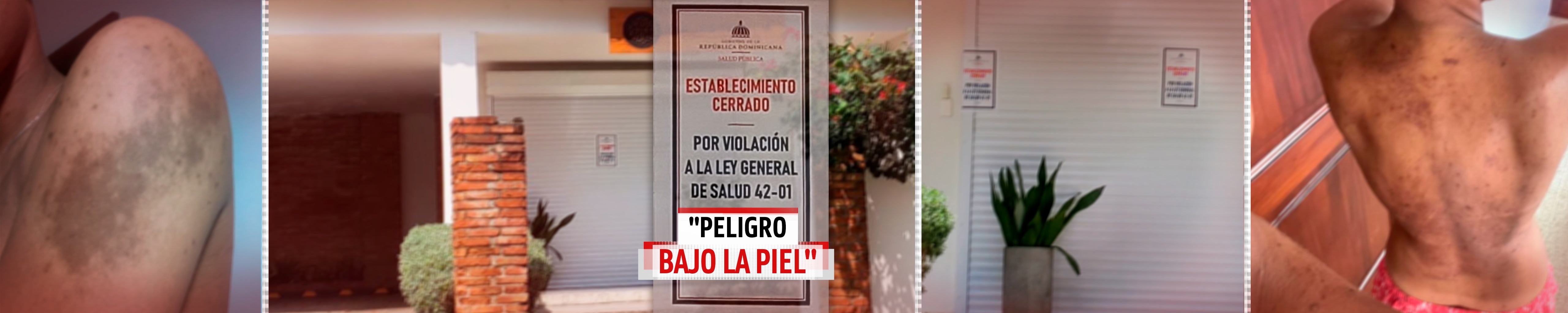PELIGRO BAJO LA PIEL